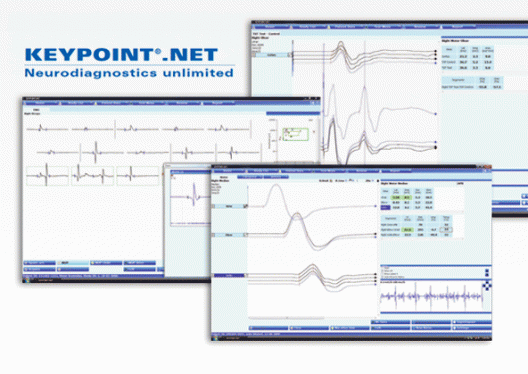Keypoint.NET Software EMG PES PEA PEV PEM VCN motrices sensitives fibre unique