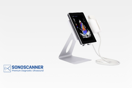 U-Lite ultra-portable high-performance ultrasound system for the point-of-care (POC), emergency units, ambulance, Radiologiy, Obstetrics, Gynecology, soft tissues, MSK (Rhumatology, Neurology, Orthopaedics), Anesthesia, Urology, Vascular diagnostics, Abdomen, pediatrics